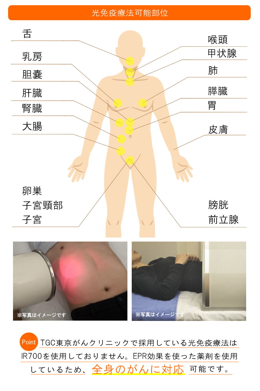光免疫療法(茨城の方へご紹介)2