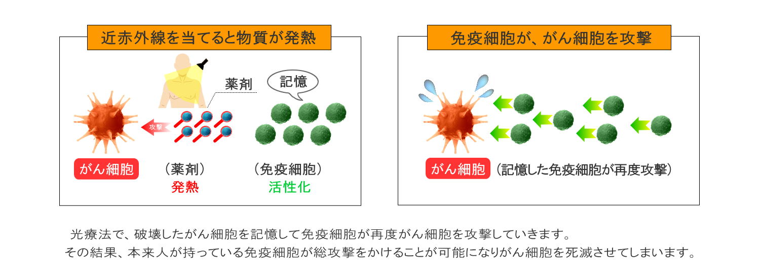 光免疫療法(茨城の方へご紹介)3
