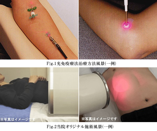 当院の光免疫療法とは width=
