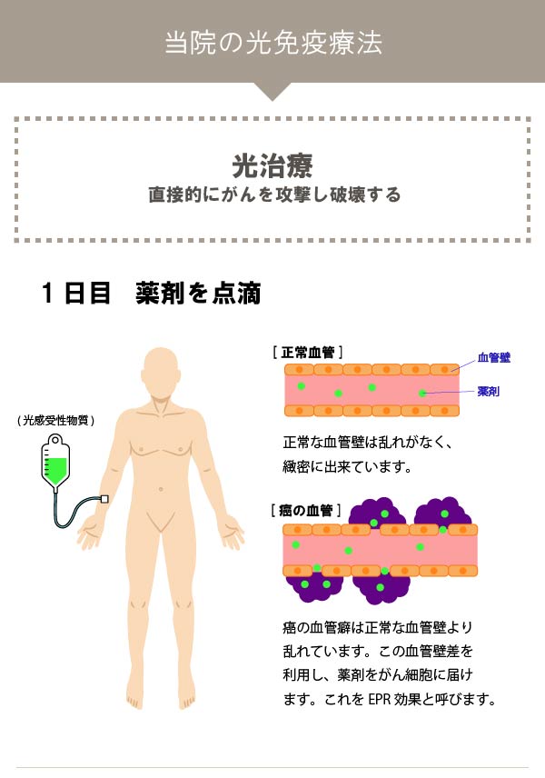 当院の治療方法